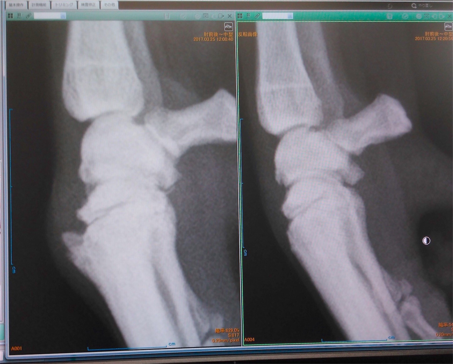 f:id:joju8:20170328214845j:image