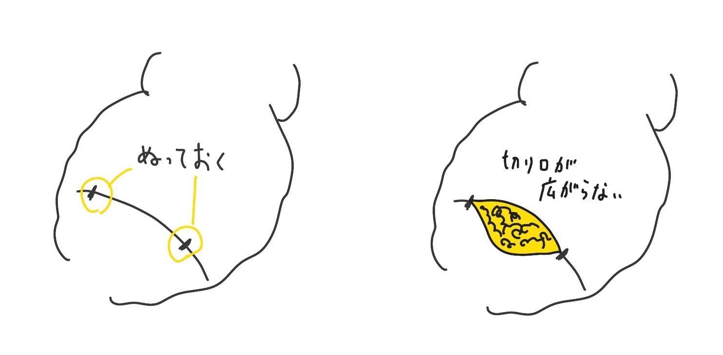 f:id:joko0108:20190528090606j:plain