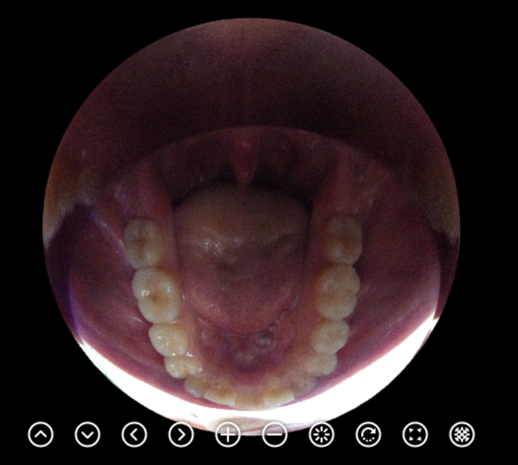 口の中まで360です すごいこと考える人いるね Jp360pic