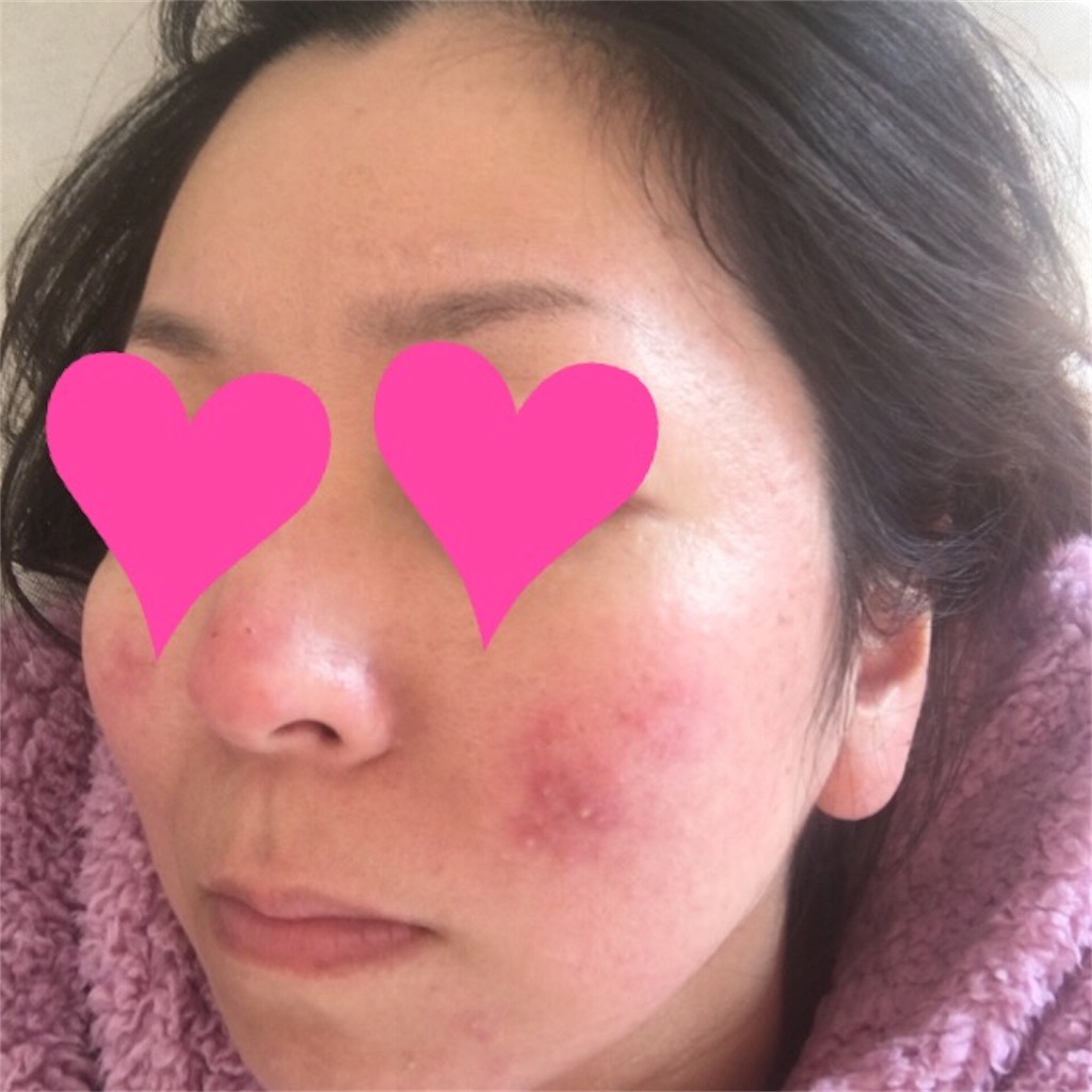 f:id:jumping2the4:20190701150520j:image f:id:jumping2the4:20190701150520j:image