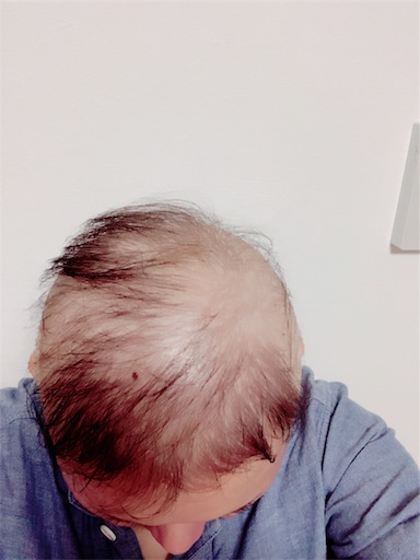 f:id:juringochang:20190219225204j:image f:id:juringochang:20190219225204j:image