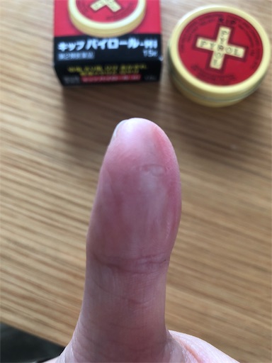 f:id:juringochang:20190228133841j:image f:id:juringochang:20190228133841j:image