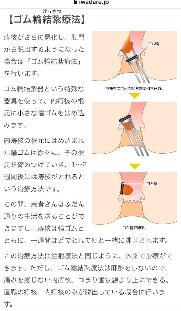 f:id:just_try:20210522211722j:image