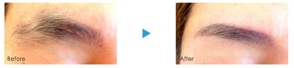 f:id:juverk:20140129150226j:plain