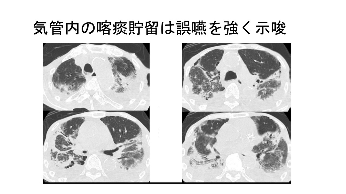 f:id:jyoutoubyouinsougounaika:20211119191203j:plain