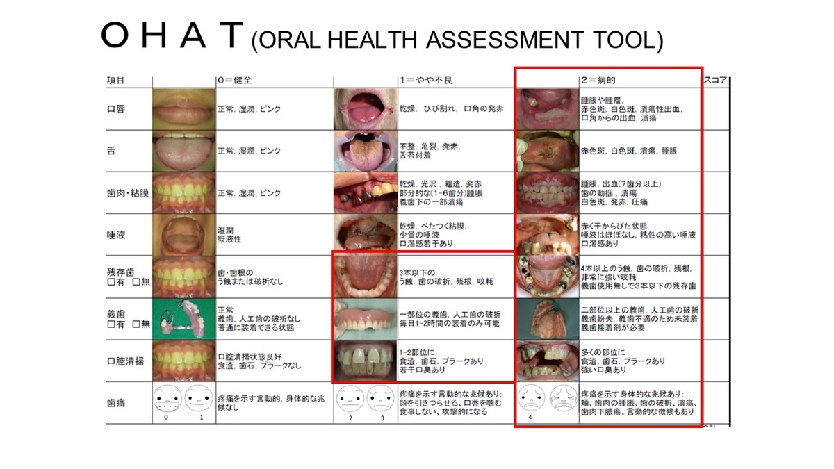 f:id:jyoutoubyouinsougounaika:20211119191248j:plain