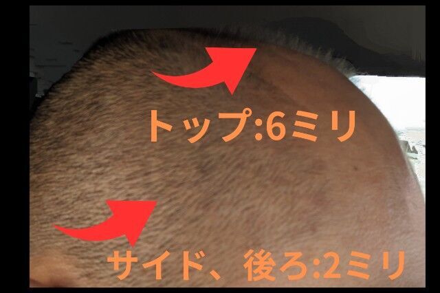 f:id:k_k_azuki:20240122210305j:image