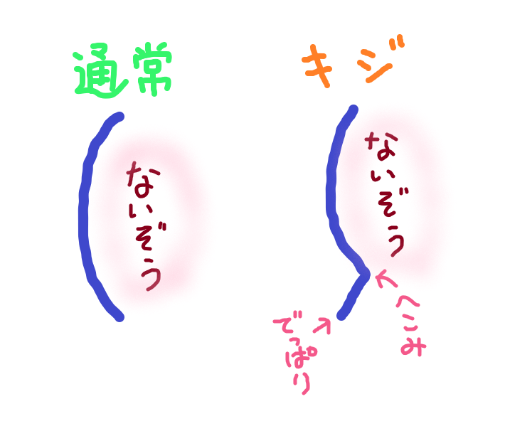 ドキッ 猫の胸にコリコリした出っ張りが やれることだけやってみる ドキッ 猫の胸にコリコリした出っ張りが やれることだけやってみる