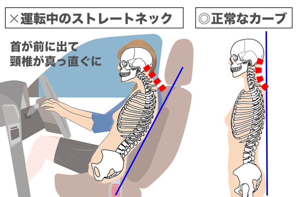 正常な頸椎のカーブとストレートネックになった頸椎の図解