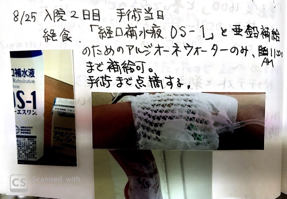 子宮筋腫の手術当日