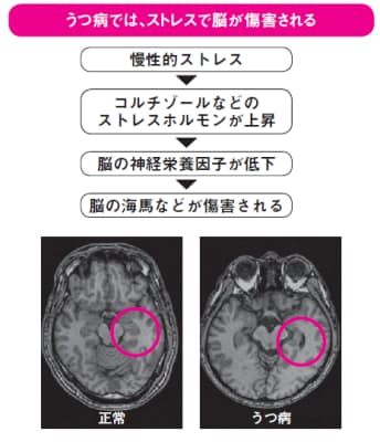 f:id:kaltochan:20220211055620j:plain