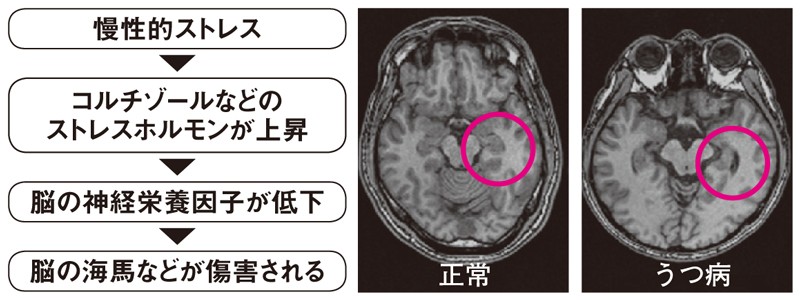 f:id:kaltochan:20221201135103j:image