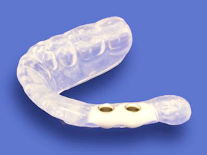 f:id:kamenutsu:20180112225055j:plain