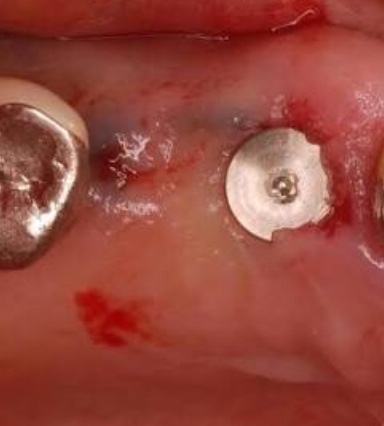 f:id:kamenutsu:20180112225447j:plain