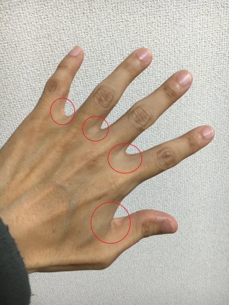 手指の 水かきモミモミ の実践で 心拍数 睡眠の質を改善することができた まさか 自分がウツになるなんて