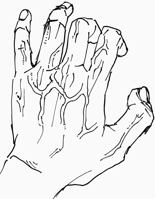 手の血管を描きました