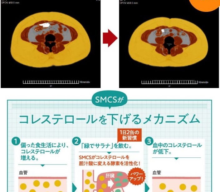 40代ダイエット 脂肪を落とす調味料 痩せる習慣で痩せない体質を克服 20代30代より有利な面も 毎日ｹﾞｰﾑとﾀﾞｲｴｯﾄが生き甲斐