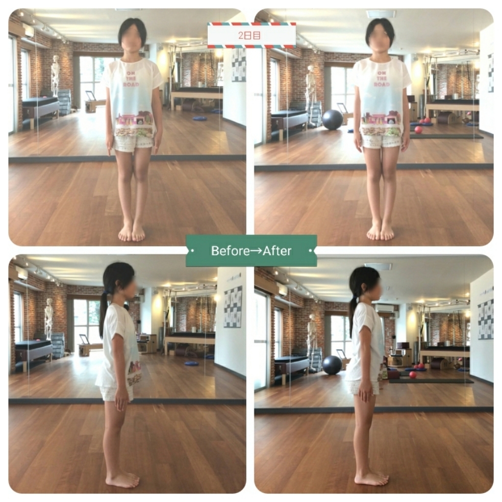 f:id:kanakoxisono:20170903215523j:plain