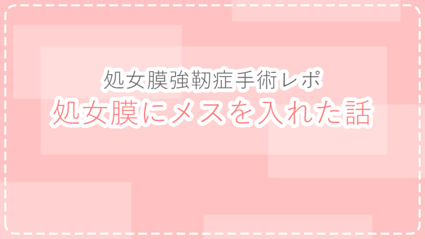 f:id:kannso:20180303171454p:plain f:id:kannso:20180303171454p:plain