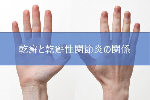 関節破壊をともなう乾癬性関節炎