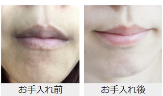 f:id:kaorimama-usa:20180523154325j:plain f:id:kaorimama-usa:20180523154325j:plain