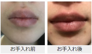 f:id:kaorimama-usa:20180523154645j:plain f:id:kaorimama-usa:20180523154645j:plain