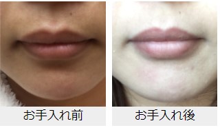 f:id:kaorimama-usa:20180523154932j:plain f:id:kaorimama-usa:20180523154932j:plain