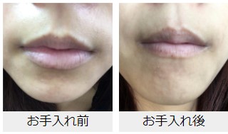 f:id:kaorimama-usa:20180523161651j:plain f:id:kaorimama-usa:20180523161651j:plain