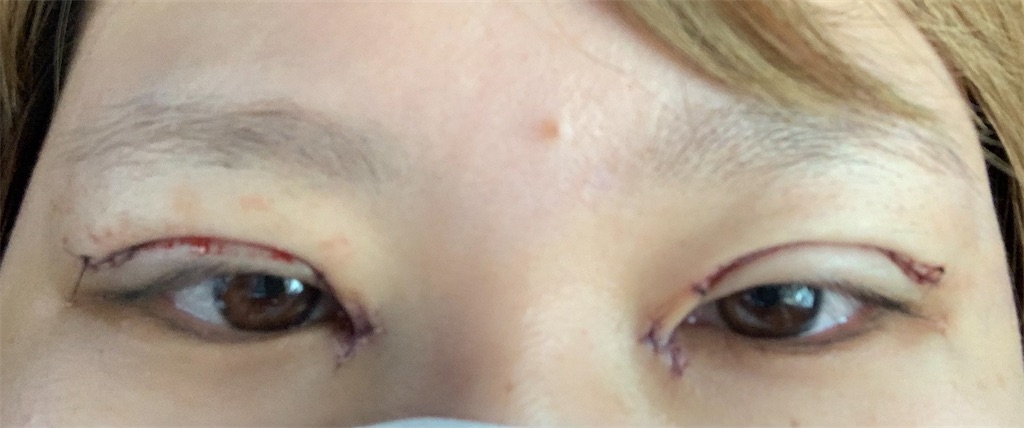 f:id:karaageechan:20210410170026j:image