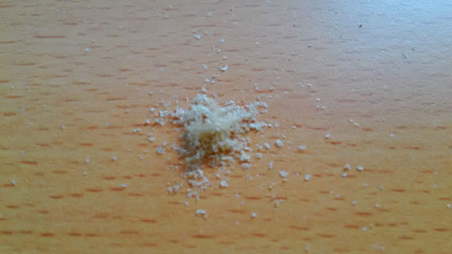 脂漏性皮膚炎(湿疹)