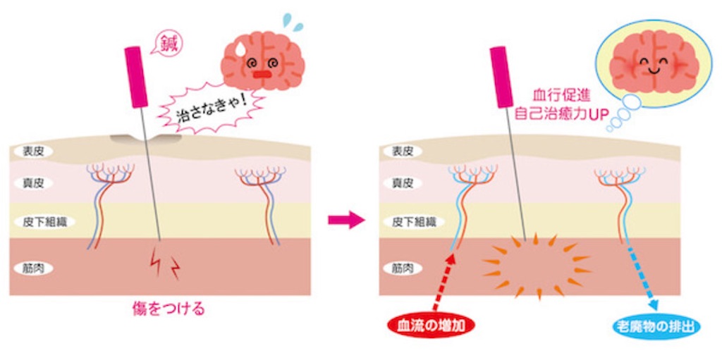f:id:katakorikaizen0309:20221013105844j:image f:id:katakorikaizen0309:20221013105844j:image
