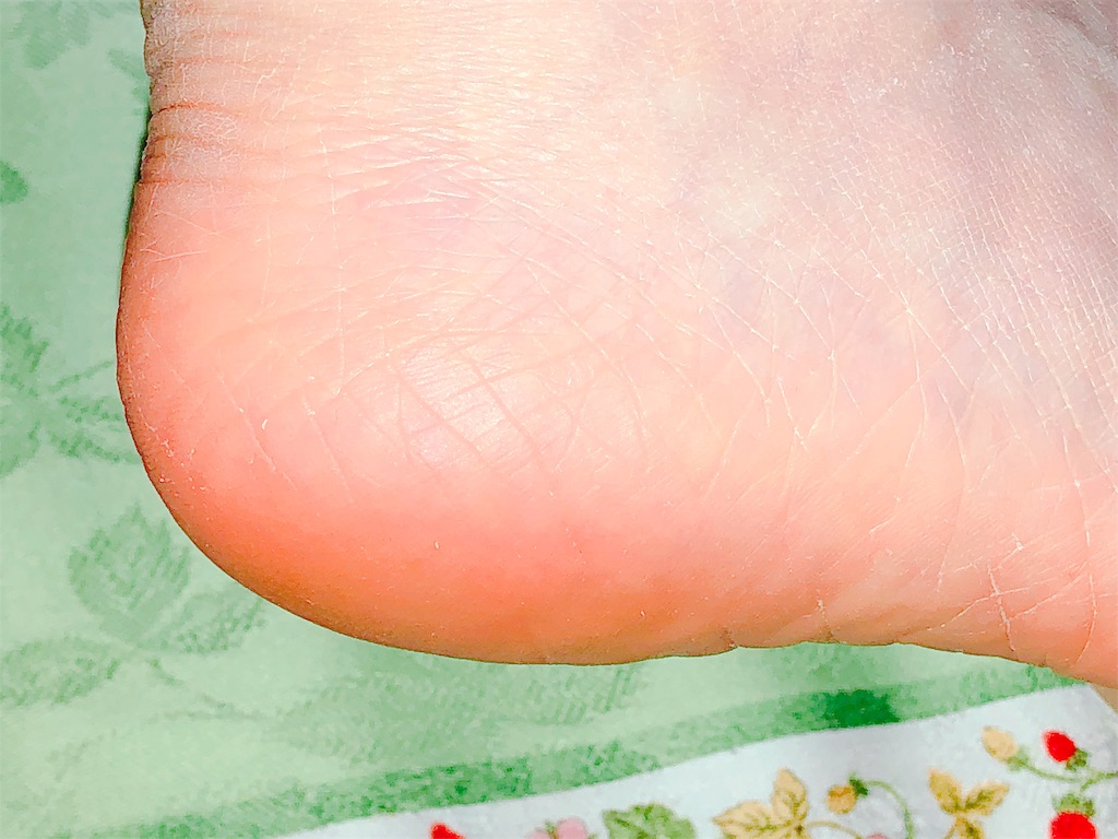 5セカンズシャイン使用後の写真