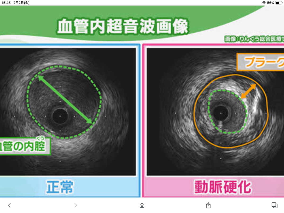 f:id:kawamuraseitai:20210703092033p:plain