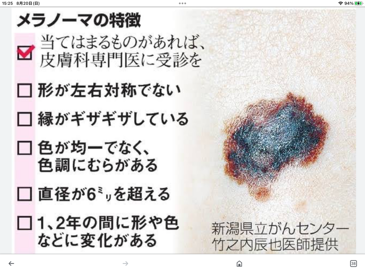 ホクロとメラノーマ(癌)の違い - 心が風邪をひいたなら