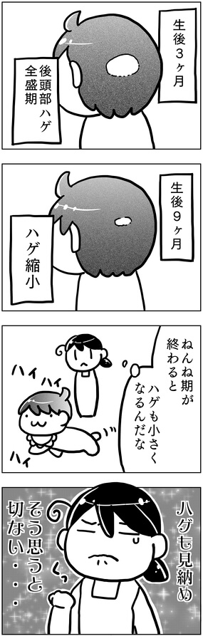 赤ちゃんの円形、後頭部ハゲ。育児漫画。