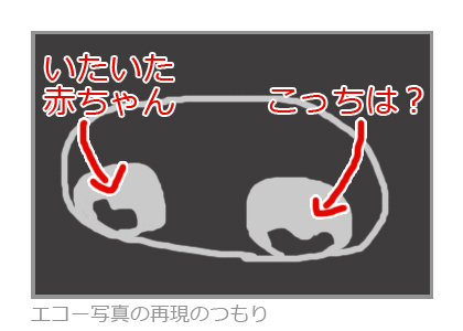 双子のエコー画像の再現