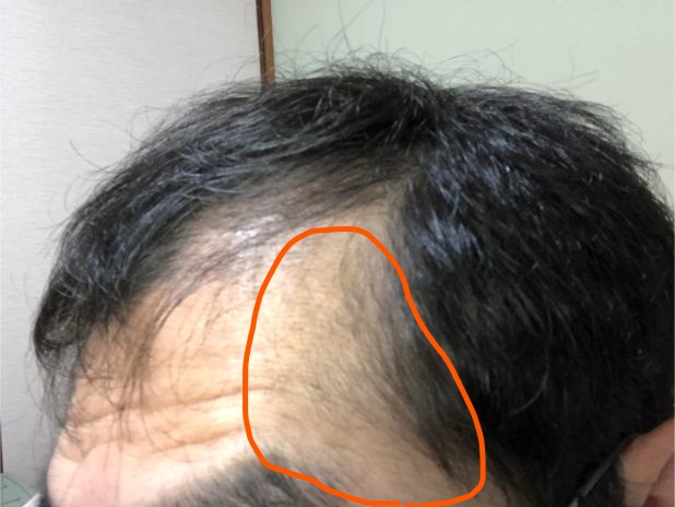 f:id:kazucchi_RT:20190417221510j:plain f:id:kazucchi_RT:20190417221510j:plain