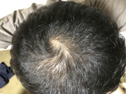 f:id:kazucchi_RT:20191110221704j:plain f:id:kazucchi_RT:20191110221704j:plain