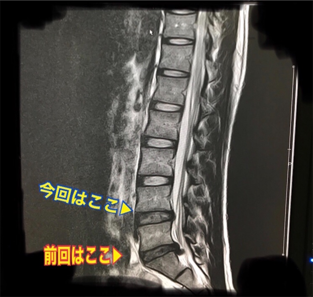 f:id:kazuki-iroiro:20200128122548j:image f:id:kazuki-iroiro:20200128122548j:image
