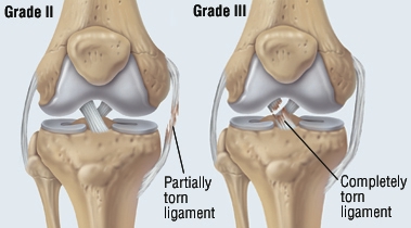 f:id:kazumax78:20180821141157j:plain