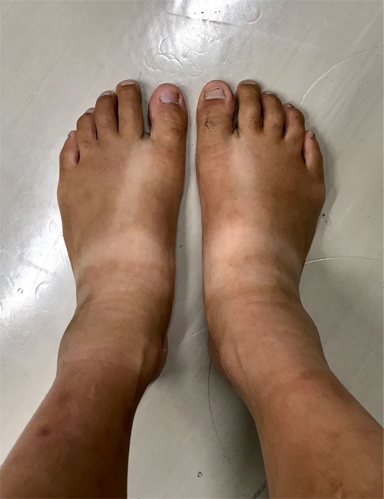 f:id:kazz-matsumura:20180619090854j:image