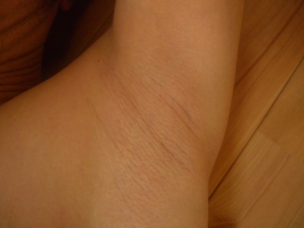 男の脇毛処理の方法にはどのようなものがあるのかまとめ 毛深い男は気持ち悪い 髭いらないしすね毛は切るかすくべき 男の脇毛処理の方法にはどのようなものがあるのかまとめ 毛深い男は気持ち悪い 髭いらないしすね毛は切るかすくべき