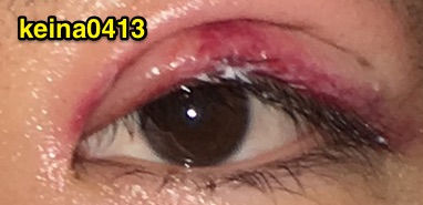 f:id:keina0413:20160223231757j:plain f:id:keina0413:20160223231757j:plain