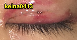 f:id:keina0413:20160223231758j:plain f:id:keina0413:20160223231758j:plain