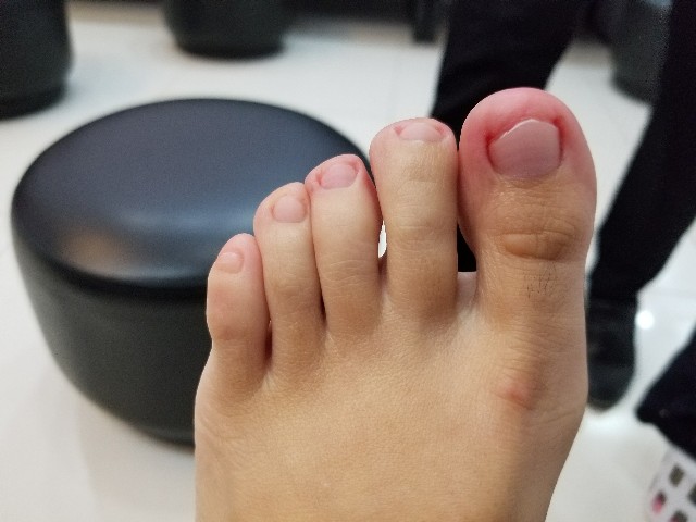 f:id:keisolutions:20180730224254j:image