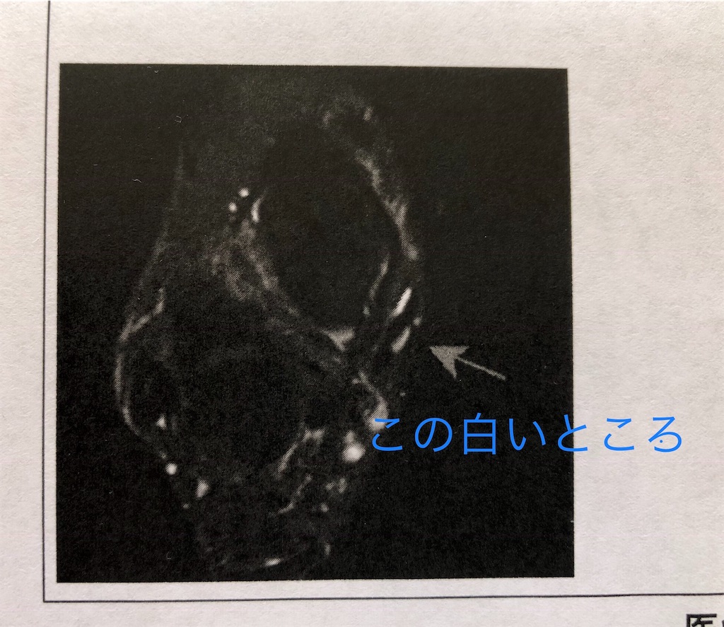 f:id:kenchan-run:20190513152858j:image f:id:kenchan-run:20190513152858j:image