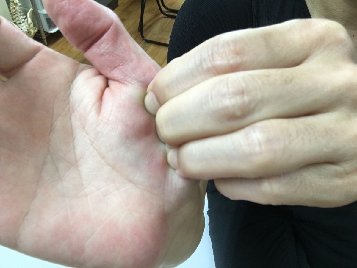 f:id:kenkou07:20190427092839j:plain f:id:kenkou07:20190427092839j:plain