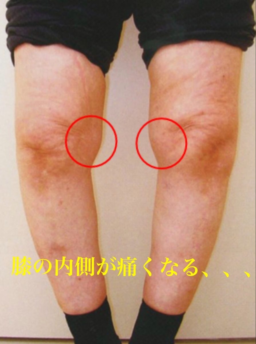 f:id:kenkoureha:20190507112750j:plain f:id:kenkoureha:20190507112750j:plain