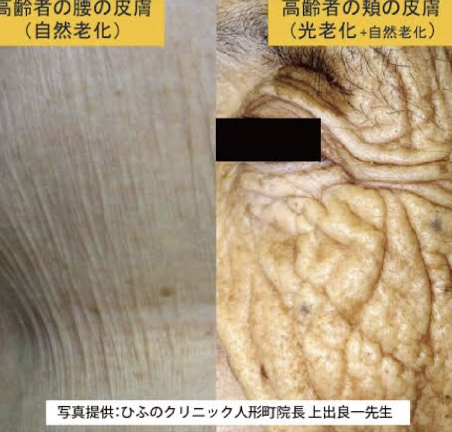 f:id:kenkoureha:20190510072525j:plain f:id:kenkoureha:20190510072525j:plain