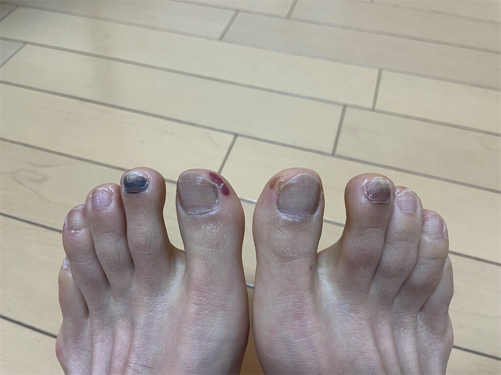 f:id:kensuke_jp:20260127081918j:image f:id:kensuke_jp:20260127081918j:image